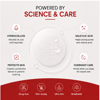 Hydrocolloid Acne Pimple Patches – 144 Patches